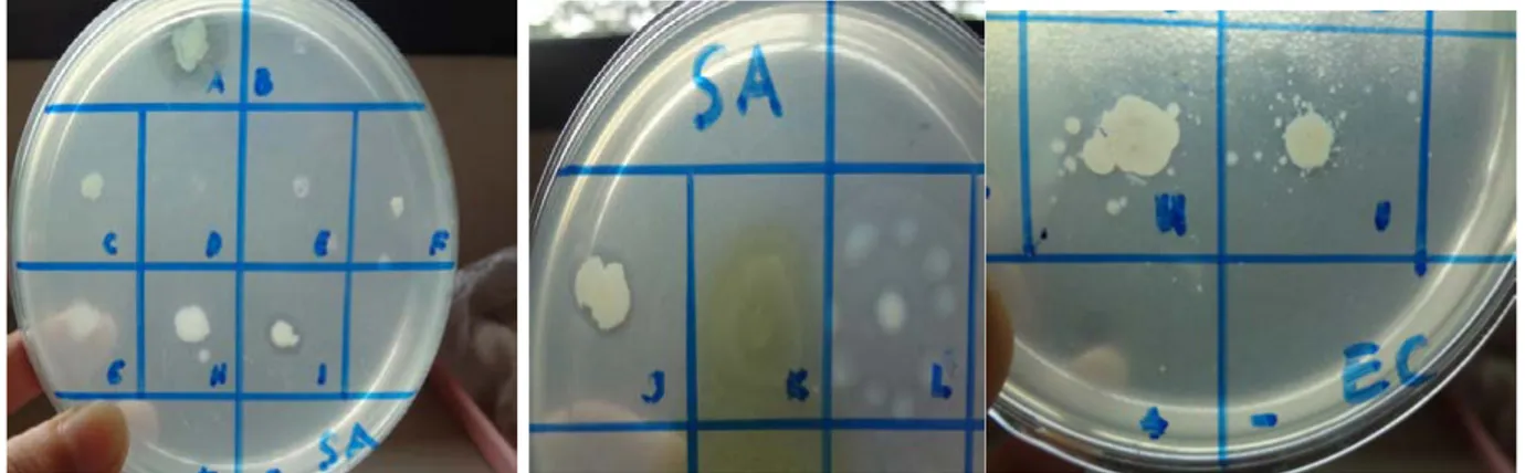 Gambar 1 Zona hambat isolat bakteri endofit terhadap S. aureus. Isolat yang menunjukkan zona hambat  adalah isolat dengan kode AS1 (A), BS1 (I) dan BS2 (J) dan kontrol positif kanamycin (dengan  tanda panah)