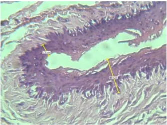 Gambar 2.  Cara pengukuran  ketebalan lapisan epitel (μm) gingiva. Pengukuran dila- dila-kukan dari lapisan basal hingga keratin secara tegak lurus