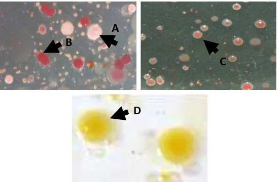 Gambar 4. Tipe morfologi isolat bakteri yang diisolasi dari serangga: A: koloni 1; B: koloni 2; C: koloni 3; D: koloni bakteri Xanthomonas sp.