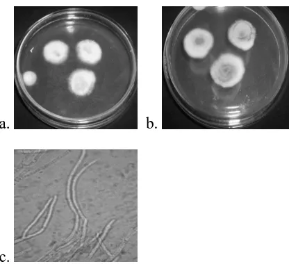 Gambar 7. (a) Koloni jamur dalam medium PDA pada masa inkubasi 7 hari; (b) ‘Reverse of colony’ jamur isolat 2 dalam medium PDA pada masa inkubasi 7 hari; (c) Morfologi mikroskopis jamur  isolat 2 (1000 x) pada masa inkubasi 7 hari