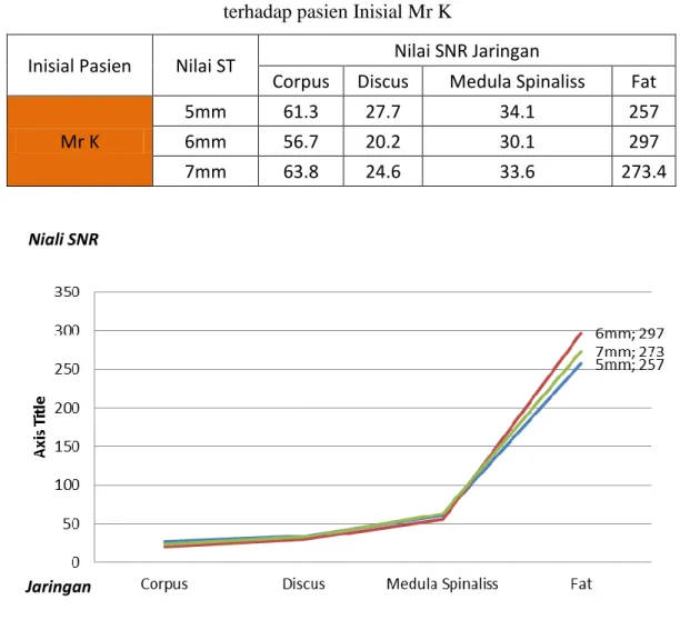 Tabel 4.2  Nilai SNR pada jaringan Corpus, Discus, Medula Spinaliss dan Fat  terhadap pasien Inisial Mr K 