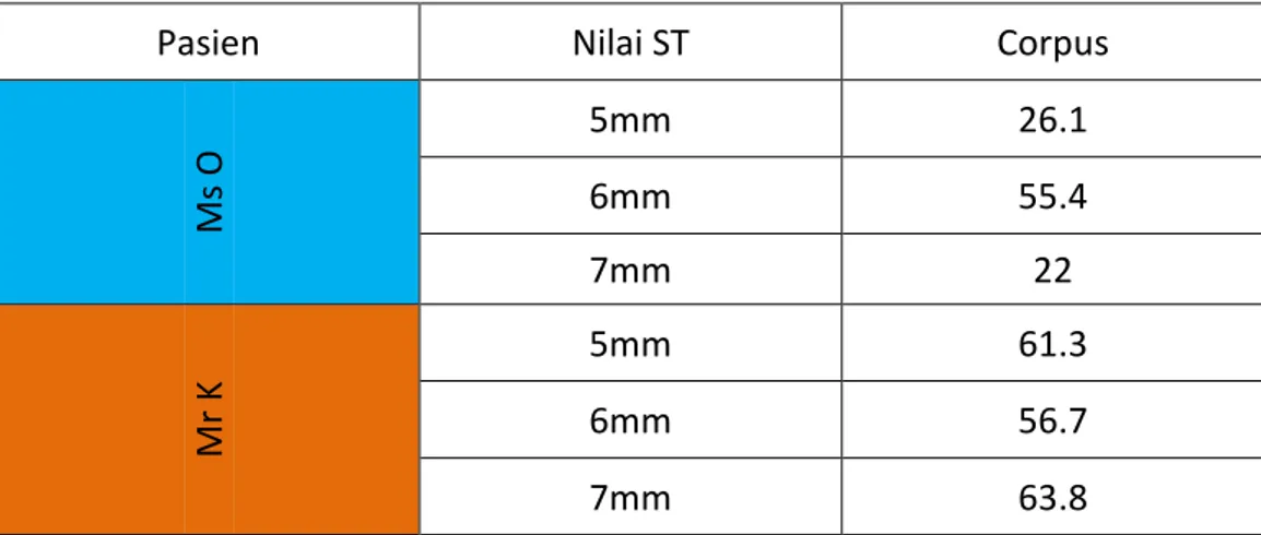 Tabel 4.3  Menghitung Nilai SNR pada Jaringan Corpus 