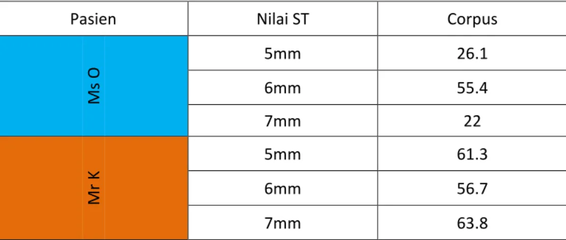 Tabel 4.3  Menghitung Nilai SNR pada Jaringan Corpus 