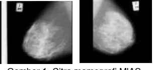 Gambar 1. Citra mamografi MIAS 