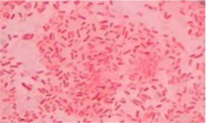 Gambar 2.2 Bakteri Salmonella sp (Rima, 2017) 