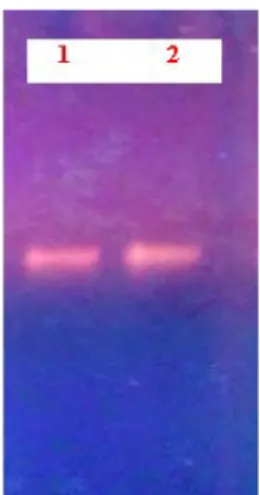 Gambar 4. Elektroforesis hasil isolasi DNA  Keterangan 1: Sampel 1 