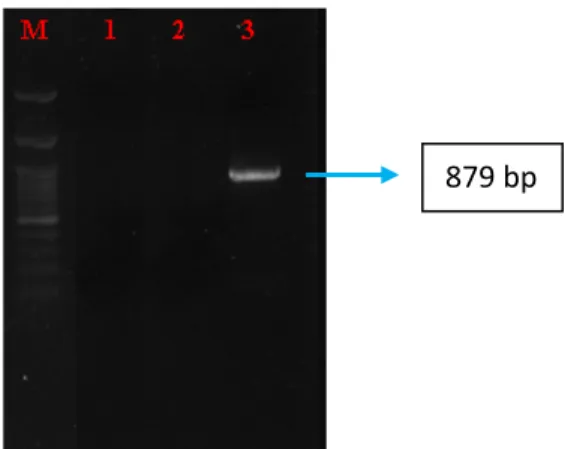 Gambar 5. Elektroforesis hasil amplifikasi gen COX1, ND4L, dan 12S rRNA sampel 1 pada  gel agarose 1,5% 