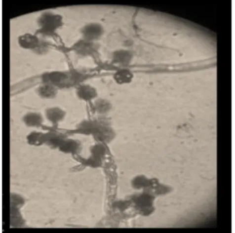 Gambar 4. Jamur T. harzianum di bawah mikroskop  (Gusnawaty et al., 2014) 