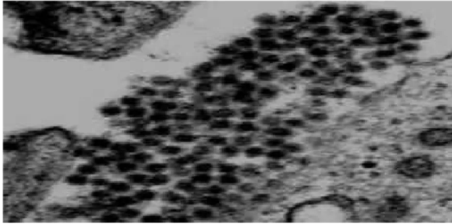 Gambar 1. Virus dengue gambaran mikroskop elektroton partikel virus dibiakan pada kultur sel.