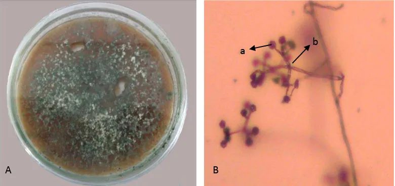 Gambar 5. Trichoderma sp. koloni umur 14 hari pada media PDA (A); dan foto mikroskopik (B), konidia (a),  Konidiofor (b) 