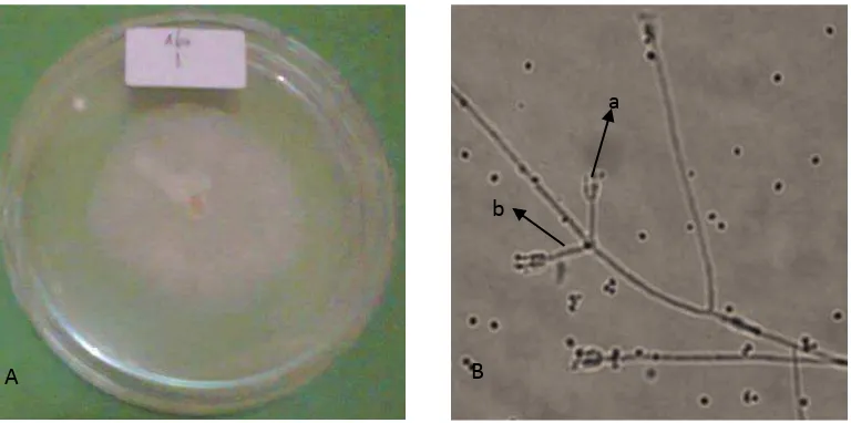 Gambar 6. Penicillium sp. koloni Umur 14 hari pada media PDA (A); dan foto mikroskofik (B), konidia(a),  konidiofor (b) 