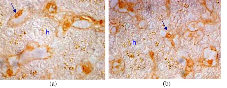 Gambar 17.  Posisi protein yang berikatan dengan AFB1 pada sel hati ayam (a) dan bebek (b)