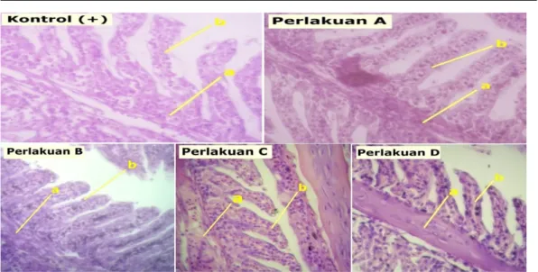 Gambar 5 Histopatologi insang kerapu tikus (Cromileptes altivelis) yang terinfeksi VNN dengan pewar- pewar-naan H-E dan perbesaran 400x