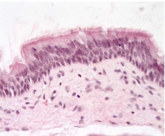 Gambar 2.2 Sel epitel transisional, pelapis nasofaring (Dikutip dari : Respiratory system pre lab [cited 2010 Jan 5]