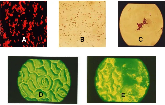 Gambar 1.  Pengamatan  mikroskopis bakteri Synechococcus sp. dan filosfer permukaan daun hasil penelitian ini;  A