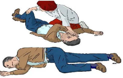 Gambar 2.7: : Recovery Position (sumber: European Resuscitation Council Guidelines for Resuscitation 2010) 