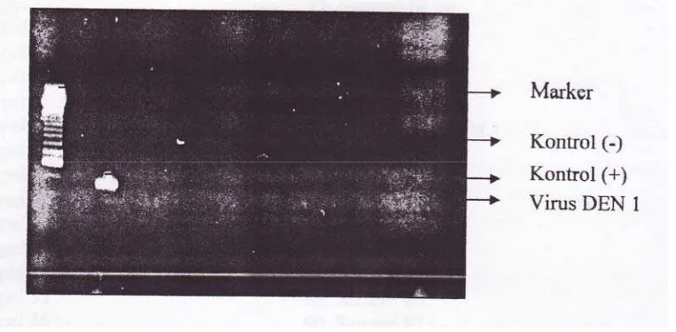 Gambar 2. Hasil RT-PCR 1 sampai 100 