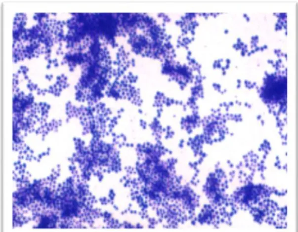 Gambar 3 Gambaran mikroskopik Staphylococcus aureus pada pewarnaan  Gram,terlihat bakteri berbentuk bulat/coccus (sumber: Yuwono, 2009) 