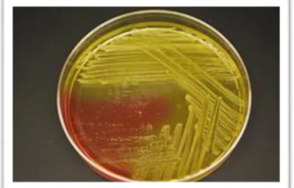 Gambar 4 Staphylococcus aureus pada agar media MSA 
