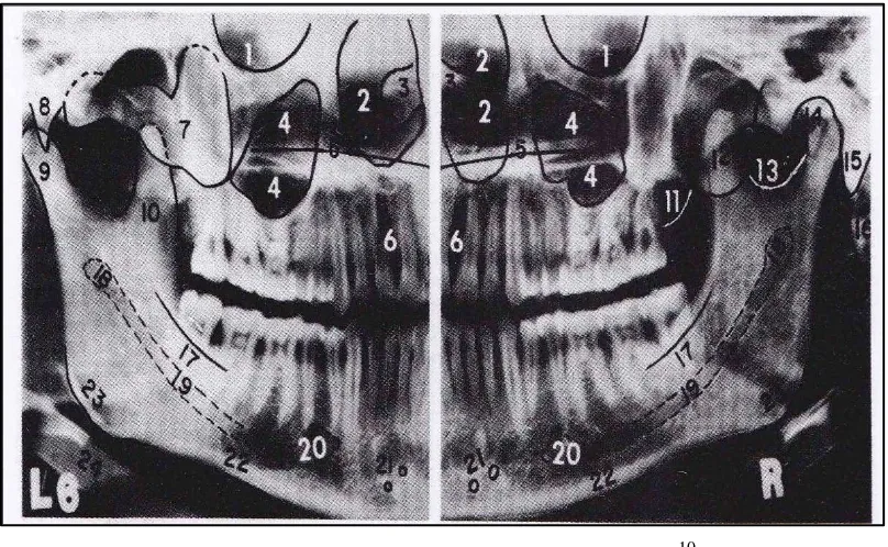 Gambar 1. Anatomi panoramik normal10 