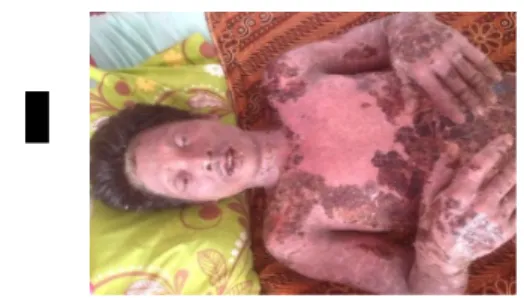 Gambar 3. Sesudah terapi 