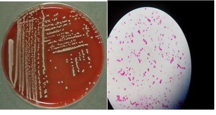 Gambar 2. A. Kultur bakteri Staphylococcus sp pada LAD danB. pewarnaan Gram positif bakteri Staphylococcus sp(http://www.microbiologyatlas.kvl.dk)