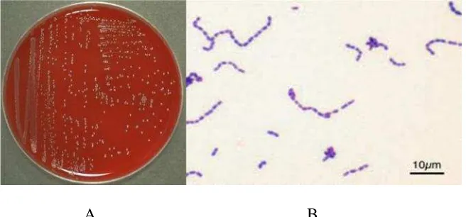 Gambar 3  A. Kultur bakteri Streptococcus sp pada LAD danB.Pewarnaan Gram bakteri Streptococcus sp(http://www.microbiologyatlas.kvl.dk)