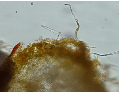 Gambar 6. Irisan melintang akar tanaman yang terinfeksi ektomikoriza 