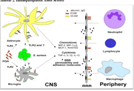 Gambar 2. Imunopatogenesis Abses Serebri 