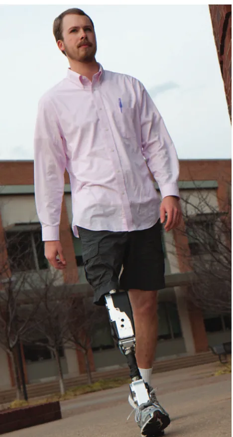 Figure 6. A subject walking with the powered prosthesis.