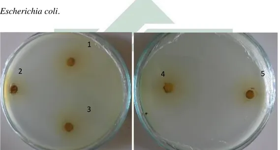 Gambar 4.4 Konsentrasi kombinasi ekstrak 75% buah dan 25% daun mengkudu  Ket: (1) Ulangan 1 diameter zona hambat 1,2 mm (2) Ulangan 2 diameter zona hambat 1 mm (3) 