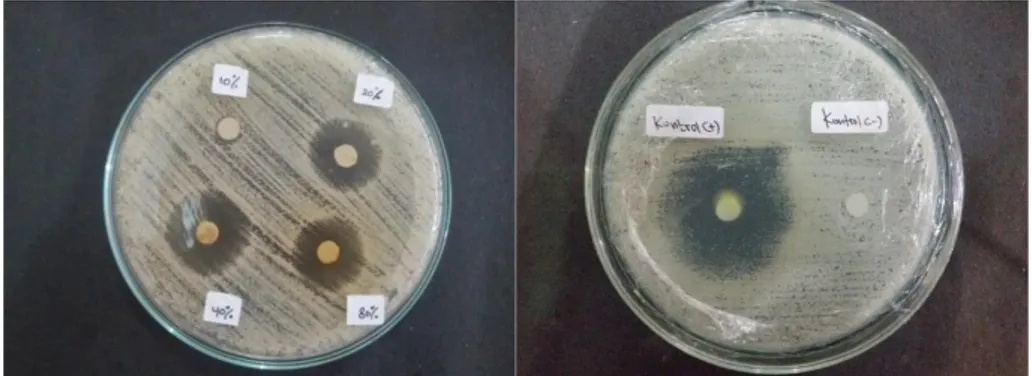 Gambar 1. Hasil uji aktivitas antijamur ekstrak etanol biji buah langsat  (Lansium domesticum Corr.) terhadap Candida albicans 
