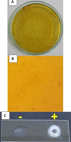 Gambar 2. Hasil Karakterisasi Bakteri V.  cholerae (A) Media TCBS, (B) Pewarnaan 