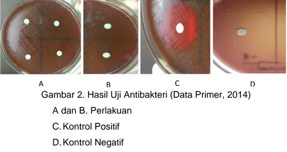 Gambar 2. Hasil Uji Antibakteri (Data Primer, 2014)  A dan B. Perlakuan  C. Kontrol Positif  D