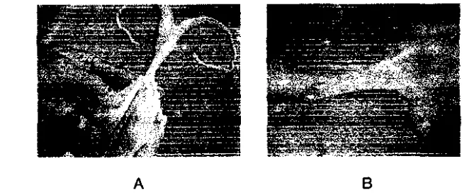 Gambar 10 Saluran reproduksi domba garut betina (A) dan cervix (B). 