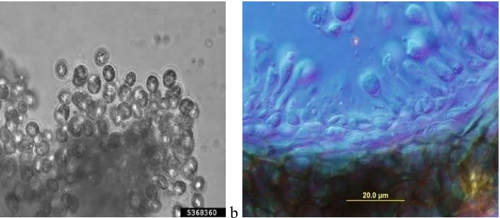 Gambar 1. a&b.Conidia and conidiophore Phyllosticta diakses dari  Phyllosticta patogen image : http://pmo.unmext.maine .edu               