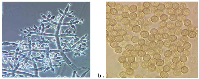 Gambar 5. (a) Konidiofor jamur  T. harzianum    (b) Konidia T. Harzianum. 