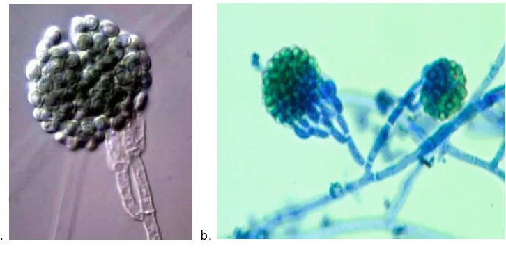 Gambar 8.a.Conidia and Phialid, b. Conidia and Conidiophore G. virens image:http://www.mycology.adelaide.edu.au/gallery/hyaline_m