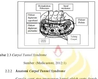 Gambar 2.3 Carpal Tunnel Syndrome 