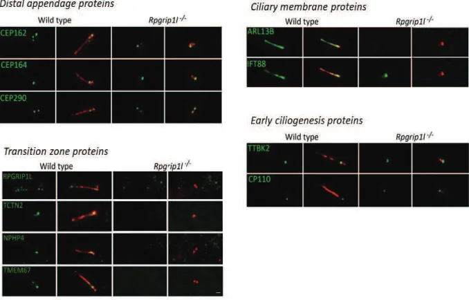 Gambar 4. Peredaman RPGRIP1L mengganggu lokalisasi protein-protein zona transisi dan membran silia 