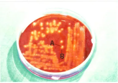 Gambar 1. Sifat hemolisis Clostridium perfringens pada media ADP (darah  domba) 