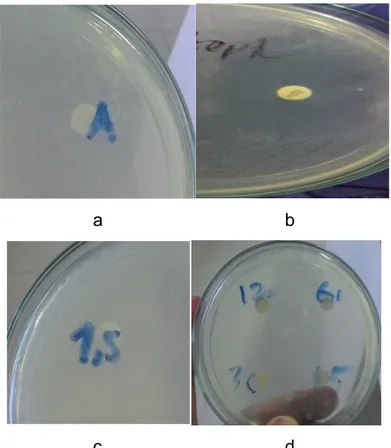 Gambar 2. Hasil uji Aktivitas Antibakteri Infusa Daun Paku Sisik Naga dan Kelompok Kontrol