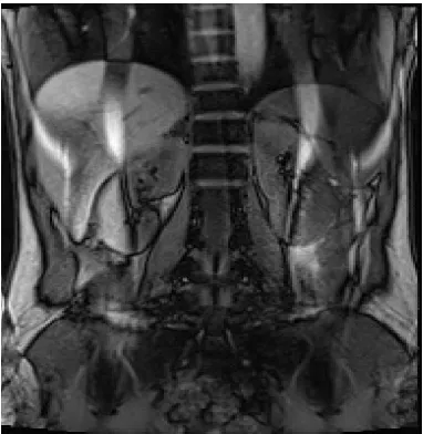 Gambar 1. MRI Adrenal