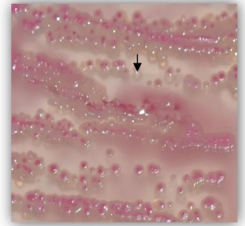 Gambar 4. E. coli yang pada media TSIA  KESIMPULAN 