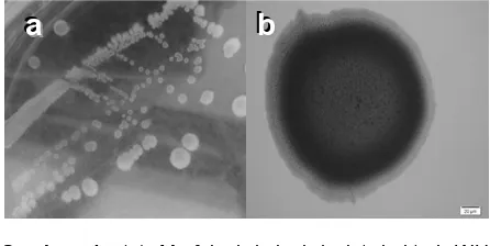 Gambar 1. (a) Morfologi koloni isolat bakteri WU 021055* pada cawan petri dan (b) Morfologi satu koloni isolat bakteri WU 021055* pada pembesaran 1000 x