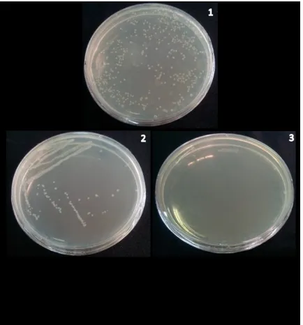 Gambar 3. Hasil transformasi plasmid pET21a(+)-acyII 