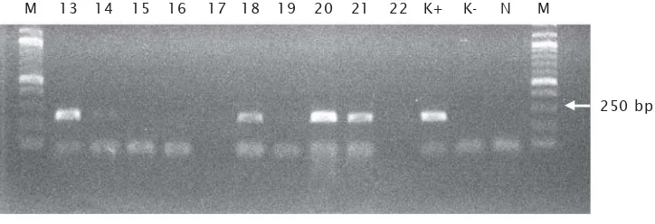 Gambar 2.  Elektroforesis hasil PCR dengan primer spesifik gen mBP-tiGH pada ikan