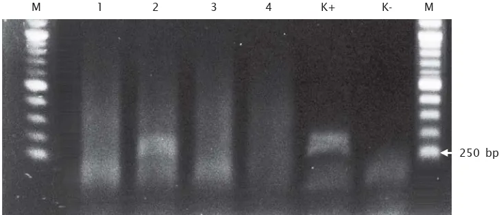 Gambar 3. Deteksi ekspresi dari transgen menggunakan metode RT-PCR