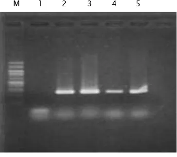 Gambar 3. Hasil amplifikasi PCR dari telur yang terinfeksi endoparasit dari