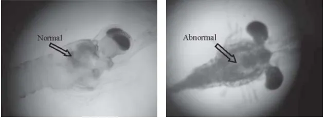Gambar 1. Gambaran kondisi hepatopankreas larva udang galah (kiri: